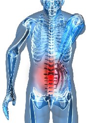 Lower back pain graphic