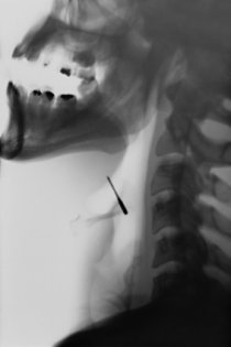 Neck X ray
